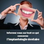 Informez-vous sur tout ce qui concerne l'implant dentaire